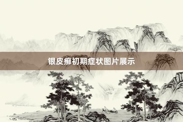 银皮癣初期症状图片展示